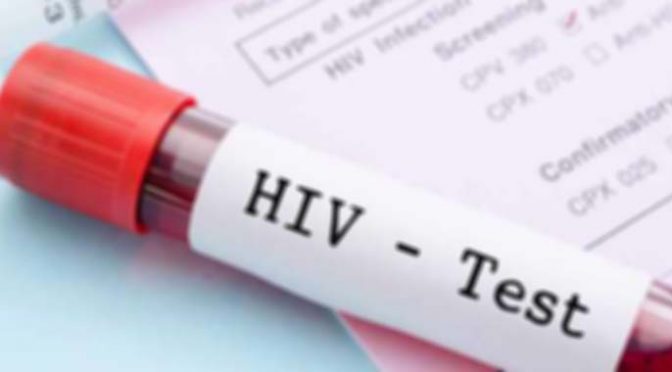 U subotu besplatno i anonimno testiranje na HIV